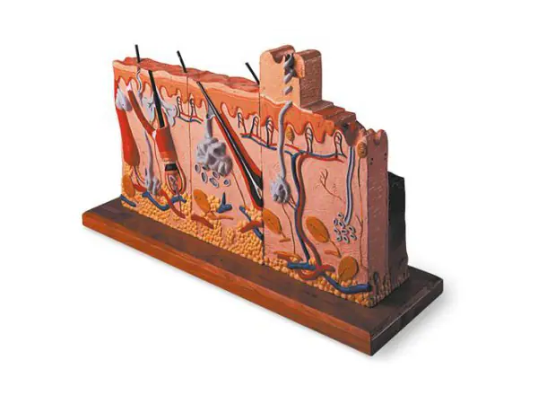 Huidmodel Serie met Brandwonden