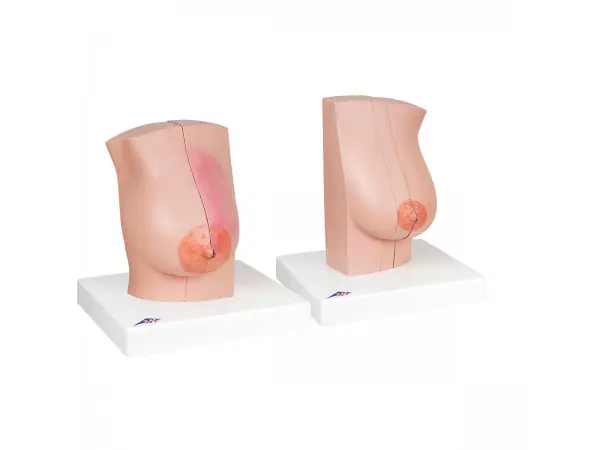 Vrouwelijke Borstmodellen Set