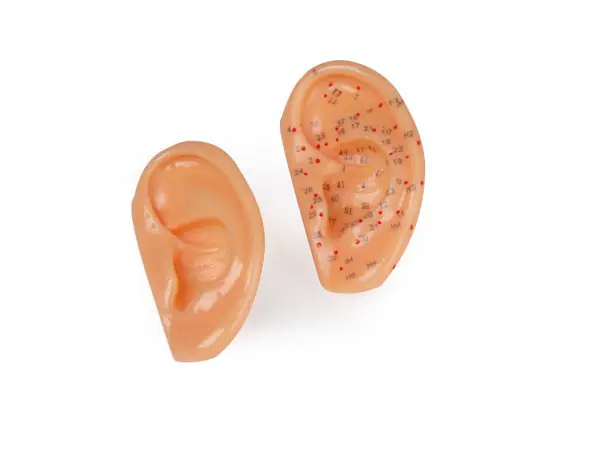 Acupunctuur Oor Set