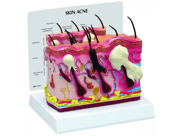 Huidacne Model, Dubbelzijdig