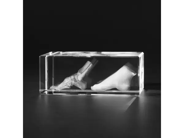 Voet en Voetskelet Glasblok