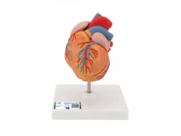 Klassiek hart met linker ventrikel hypertrofie(LHV) 2-delig