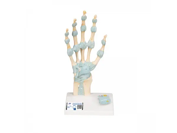 Hand met gewrichtsbanden & Carpale tunnel