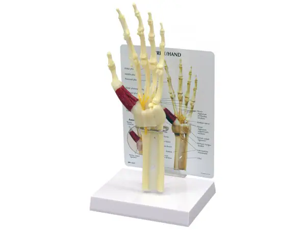 Hand/Pols met Carpaaltunnel syndroom