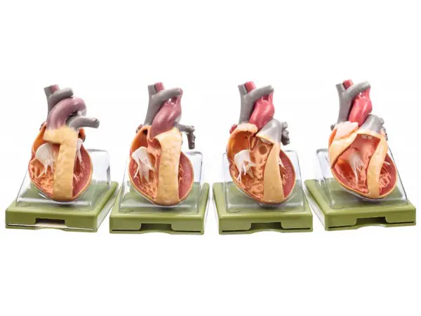 Aangeboren Hartziektes Modellen Set