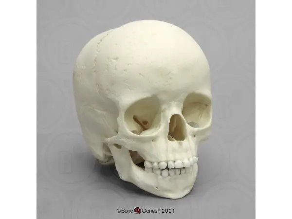 Archaische Schedel Kind, 5 jaar