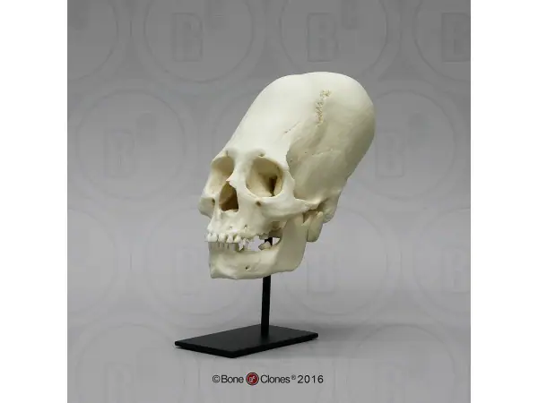 Vrouwelijk Model Schedelbinding