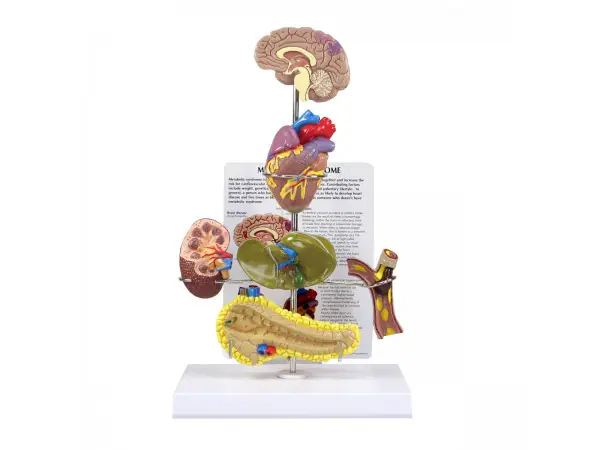 Metabool Syndroom Model