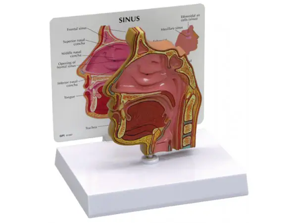 Sinus (schedelholte)