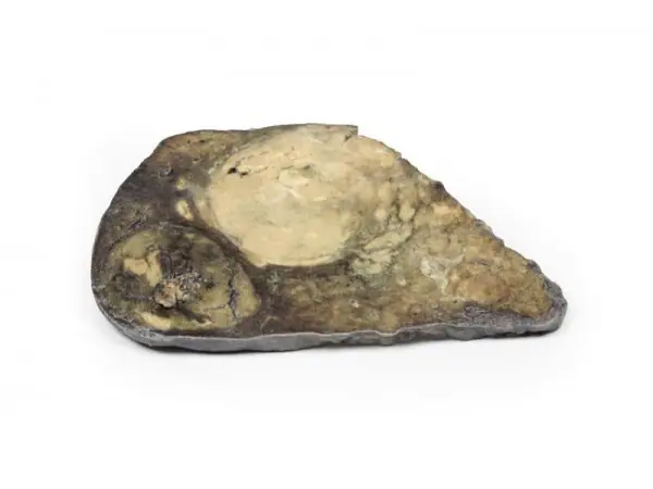 Hepatocellulair Carcinoom, 3D Print