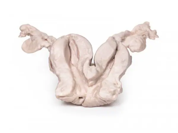 Uterus Bicornis Unicollis, 3D Print