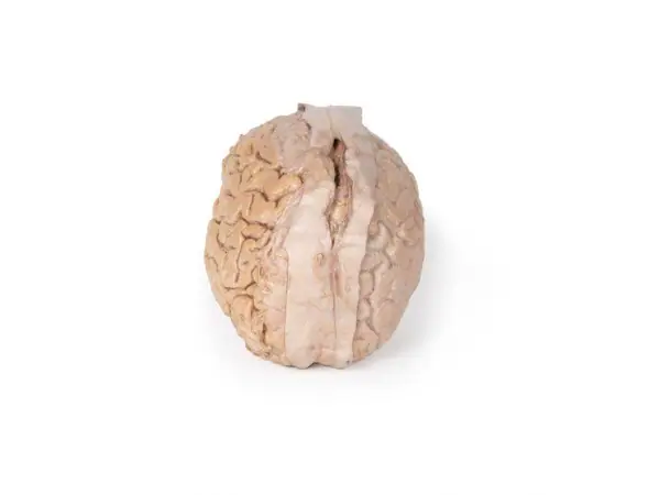 Hersenen (Cerebrum), 3D Print