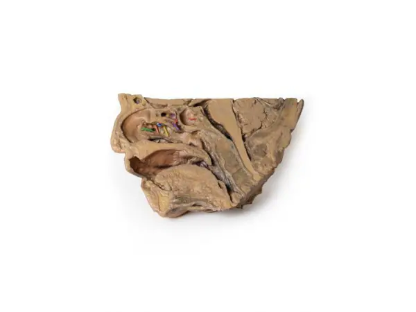 Neusbijholten, 3D Print