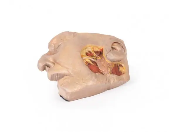 Parotisklier en Gezichtszenuw Dissectie, 3D Print