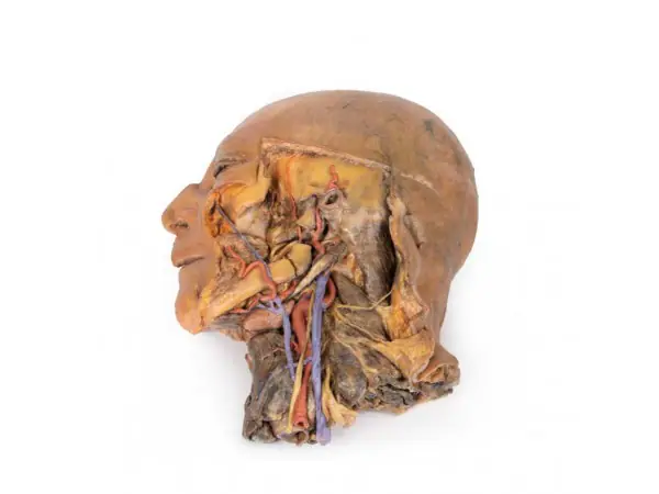 Sagittale Doorsnede Hoofd en Nek met Dissectie, 3D Print