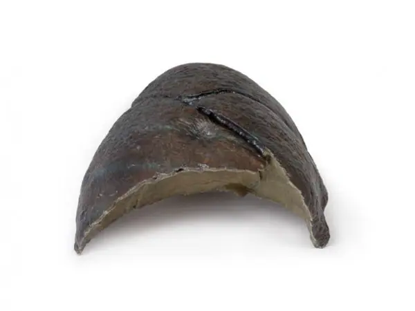 Rechter Long, hilum verwijderd, 3D Print