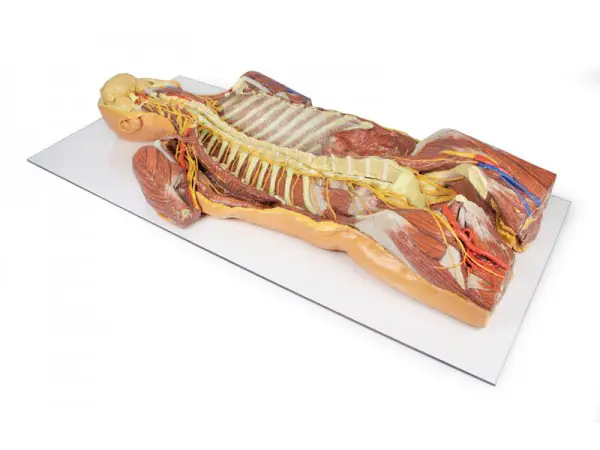 Posterieure Lichaamswand/Ventrale Diepe Dissectie, 3D Print
