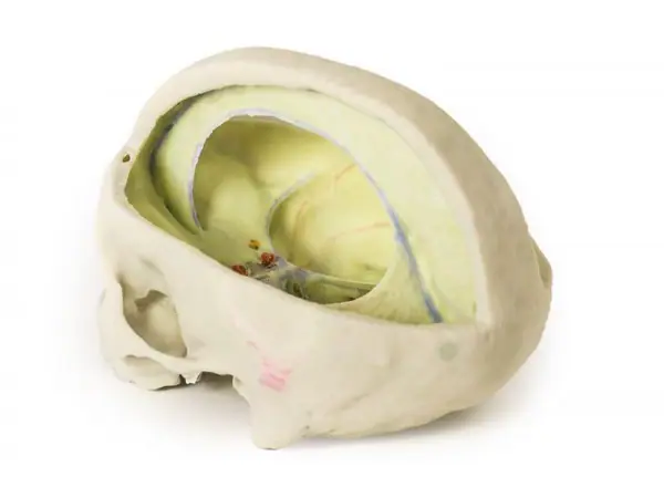 Durale Schedel, 3D Print