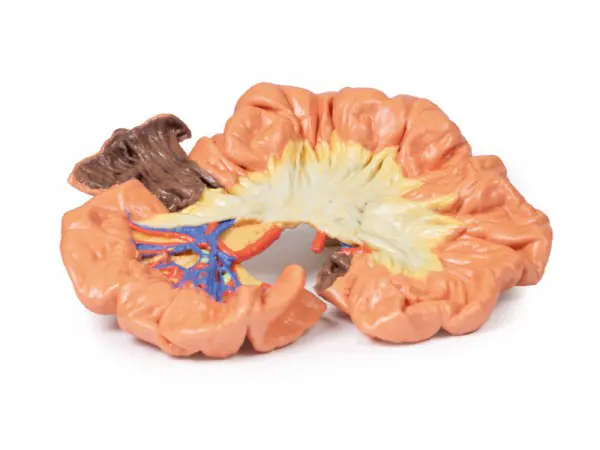 Darm - deel van het ilium, 3D Print