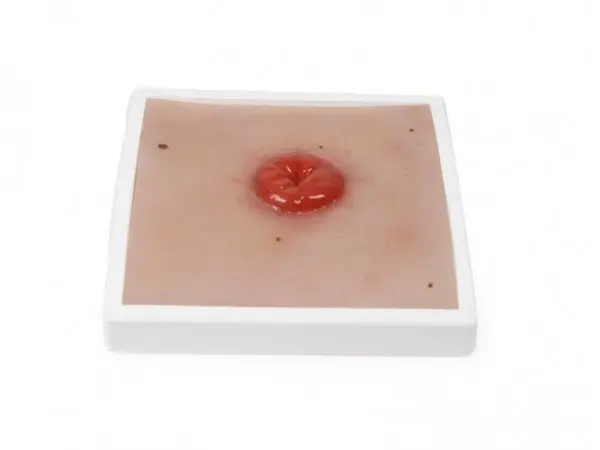 Colostoma Model