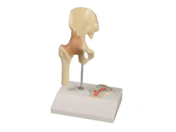 Mini Heupmodel met Dwarsdoorsnede