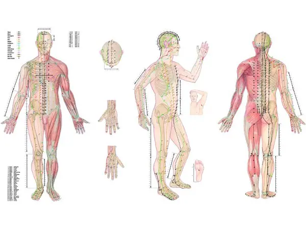 Body Acupuncture, gelamineerde wandplaat