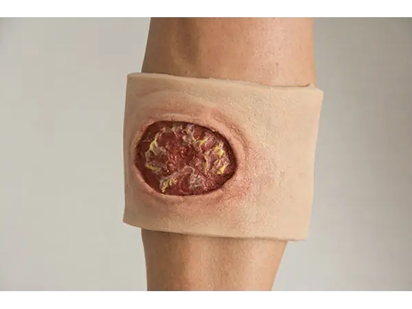 Rood-gele wond met draagband