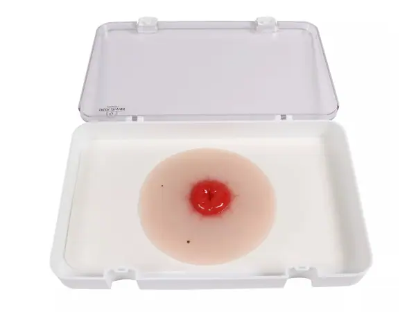 Colostomie Wondmodel, Zelfklevend