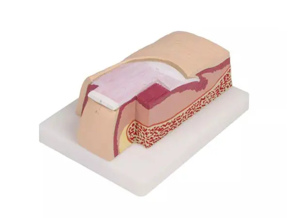 Vergroot Vingernagel model