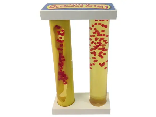 Deluxe Slagadermodel met aderververkalking
