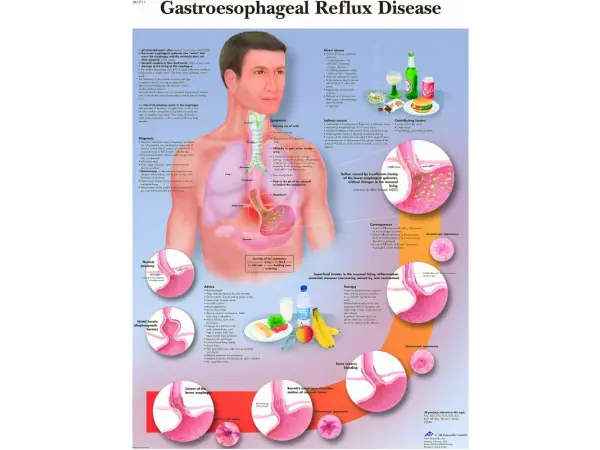 Reflux, gelamineerde wandplaat