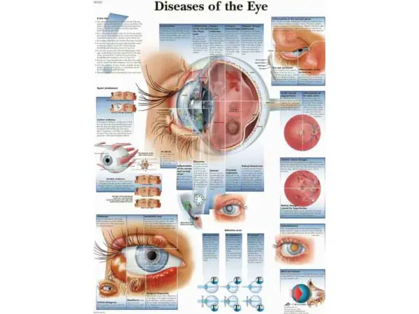 Anatomie Poster Ziektebeelden van het Oog, papier