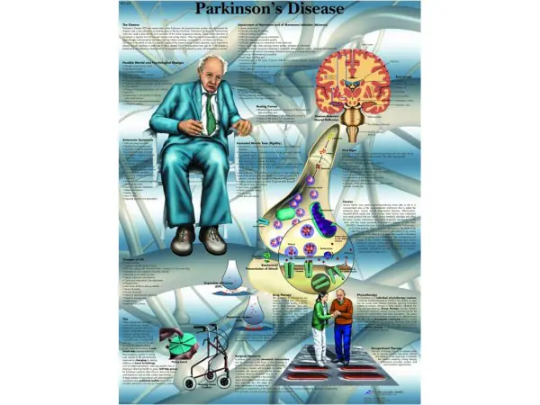 Parkinson, papieren wandplaat