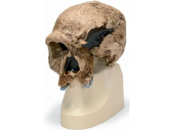 Antropologische Schedel Steinheim