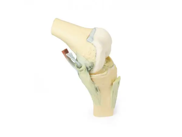 Knie, gebogen, 3Dprint
