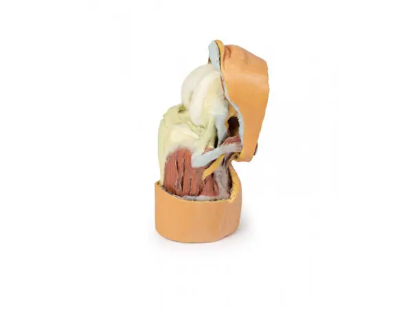 Gebogen knie met diepe dissectie, 3Dprint