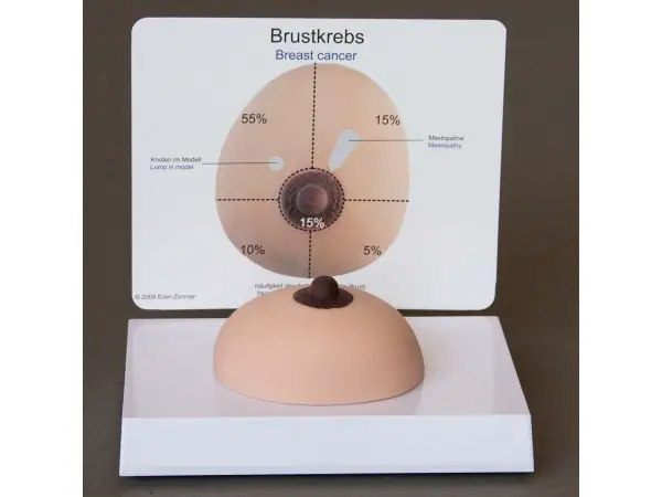 Borstkanker, zacht weefsel