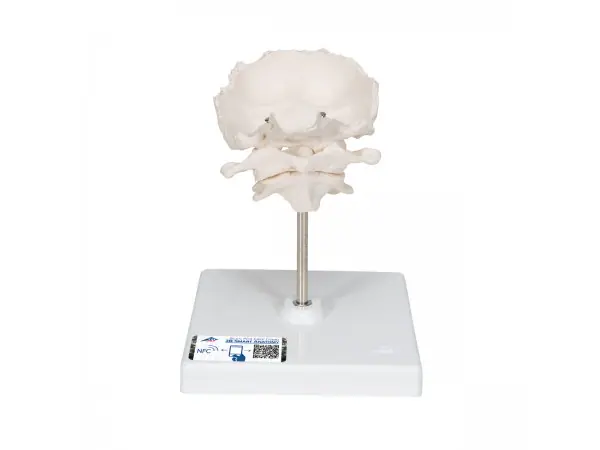 Atlas, draaier & occipitaal bot