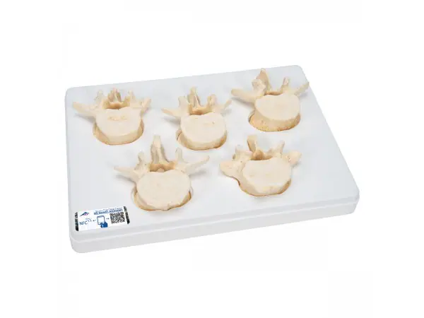 set van 5 losse Lumbale wervels, BONElike