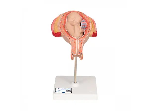 Foetus model stuitligging maand 5