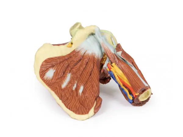 Schouder links, diepe dissectie, 3Dprint