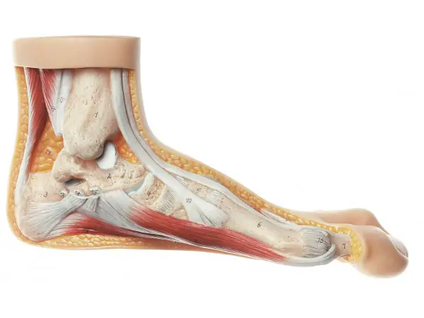 Voet met Hallux valgus