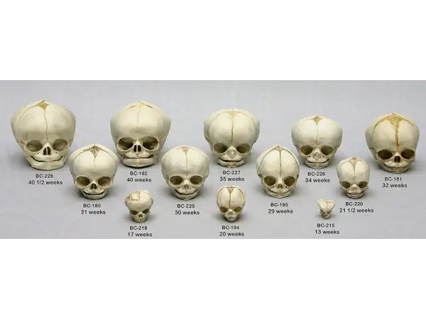 Foetus set van 12 schedels op standaard