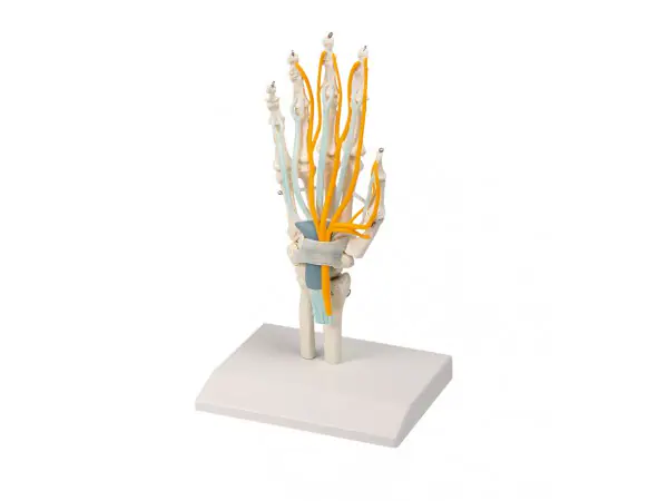 Handmodel met Pezen, Zenuwen en Carpaal Tunnelsyndroom