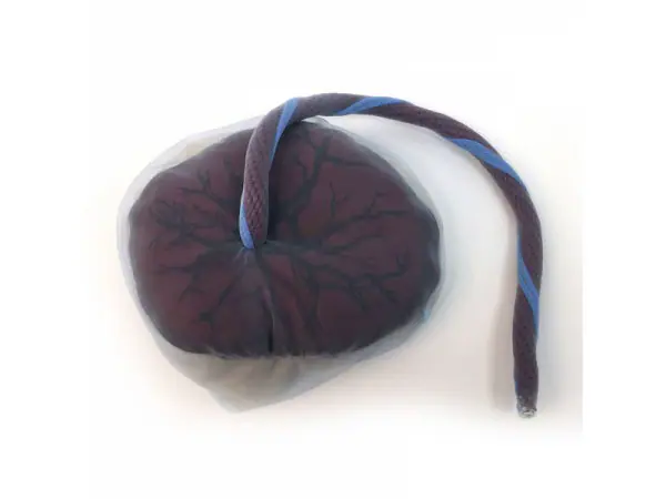 Placenta en navelstreng